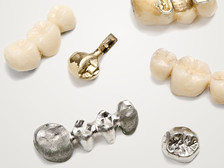 Zahnersatz und Implantate